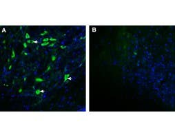 Anti-GPRC5B Antibody