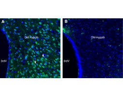 Anti-GPR75 Antibody