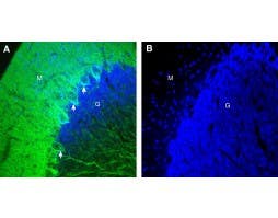 Anti-GPR158 Antibody