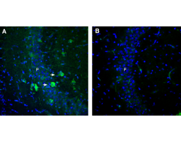Anti-GPR151 (extracellular) Antibody