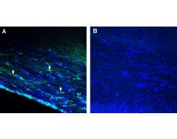 Anti-GPR143 Antibody