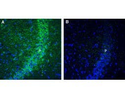 Anti-GPR160 Antibody