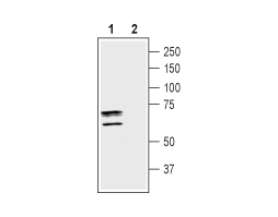 Anti-Taurine Transporter (SLC6A6) Antibody