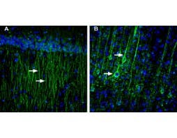 Anti-SLC6A8 Antibody