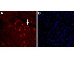 Anti-GlyT2 (SLC6A5) (extracellular) Antibody