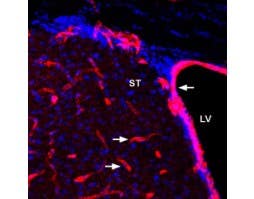 Anti-GLUT1 Antibody
