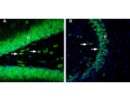 Anti-GLUT2 (SLC2A2)-ATTO Fluor-488 Antibody