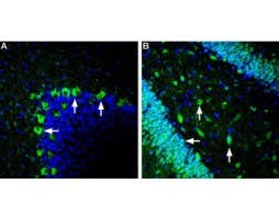 Anti-GLUT2 (SLC2A2) Antibody