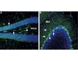 Anti-GLUT3 (extracellular) Antibody