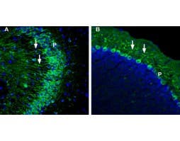 Anti-GLUT5 (SLC2A5) Antibody