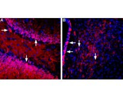 Anti-SGLT1 (extracellular) Antibody