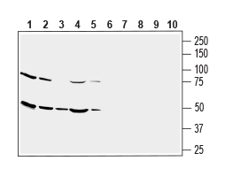 Anti-Human GLUT3 (extracellular) Antibody