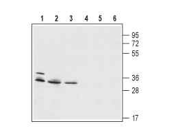 Anti-HVCN1 Antibody