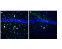 Anti-OTOP1 Antibody