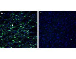 Anti-Histamine H<sub>1 </sub> Receptor/HRH1 (extracellular) Antibody