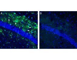 Anti-GPR81/HCAR1 Antibody