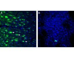 Anti-GPR109A/HCAR2 (extracellular) Antibody