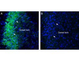 Anti-Sigma-1 Receptor Antibody
