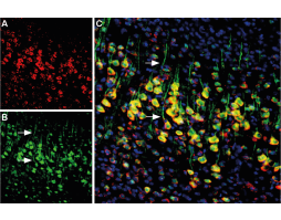 Anti-Presenilin-1-ATTO Fluor-488 Antibody
