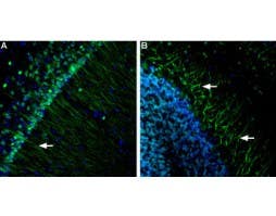 Anti-Presenilin-1 Antibody