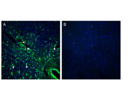 Anti-Presenilin-2 Antibody