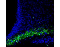 Anti-CASK Antibody