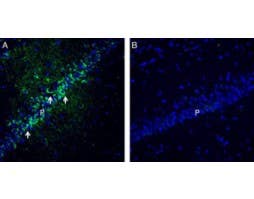 Anti-PACSIN1 Antibody