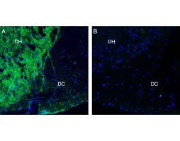 Anti-Neurofascin Antibody