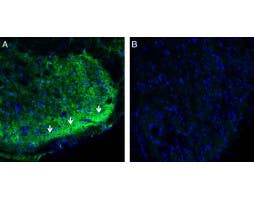 Anti-CRMP2 Antibody