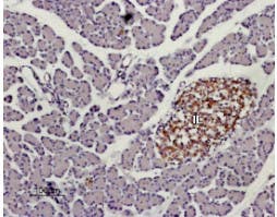 Anti-KISS1 Receptor (GPR54) (extracellular) Antibody
