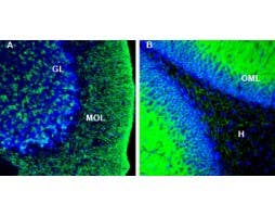 Anti-KCC2 (SLC12A5) Antibody