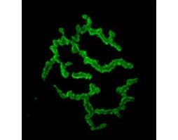 α-Bungarotoxin-FITC