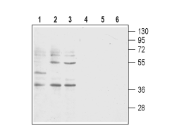 Anti-Human BLT1 (extracellular) Antibody