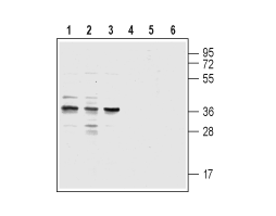 Anti-CysLTR1 (extracellular) Antibody