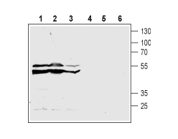 Anti-Human CysLTR2 (extracellular) Antibody