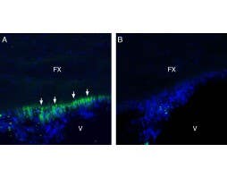 Anti-GP130 (extracellular) Antibody