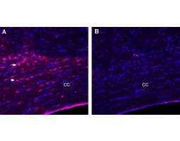 Anti-LPAR1 (EDG2) (extracellular) Antibody