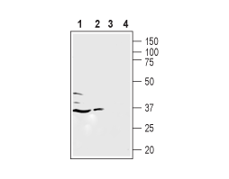 Anti-Human LPAR5 (extracellular) Antibody