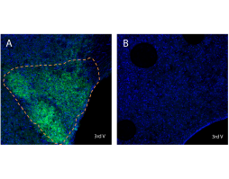 Anti-LPAR6 (P2RY5) (extracellular) Antibody