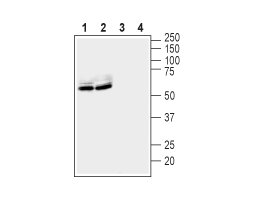Anti-LGI1 Antibody