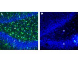 Anti-CLEC7A/Dectin-1 (extracellular) Antibody