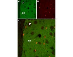 Anti-CHRM1 Antibody