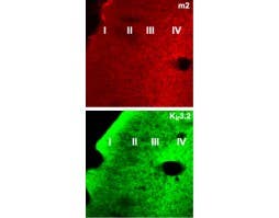 Anti-CHRM2 Antibody