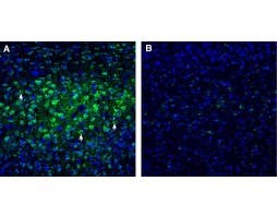 Anti-CHRM3 Antibody