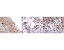 Anti-MC1 Receptor Antibody
