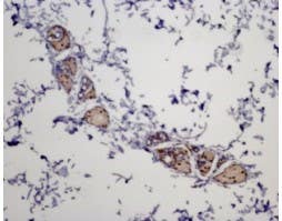 Anti-MC5 Receptor Antibody