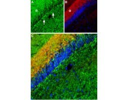 Anti-Noradrenaline Transporter (NET) (extracellular) Antibody