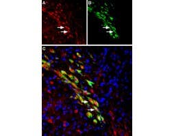 Anti-VMAT2 Antibody