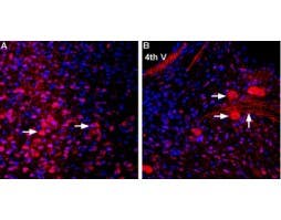 Anti-MCT2 Antibody