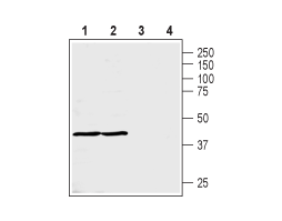 Anti-MCT3 Antibody